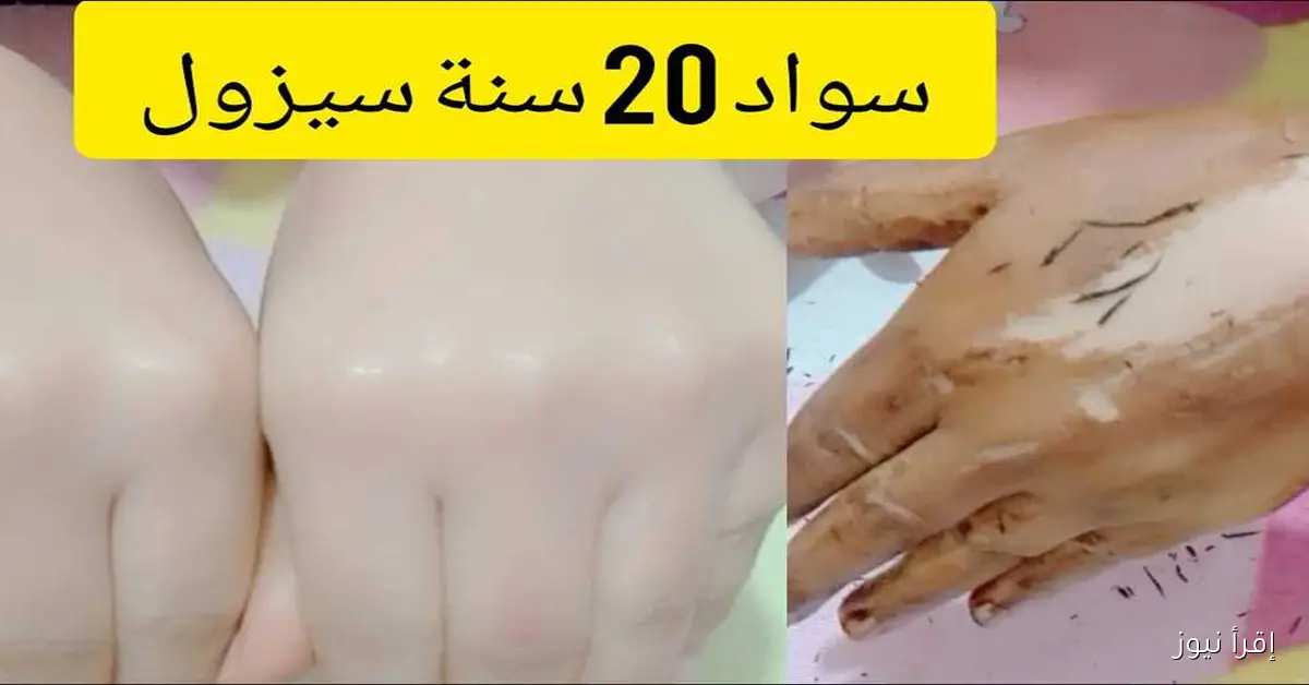 وداعًا لسواد السنين: خلطات طبيعية بالكركم والبرتقال لتفتيح البشرة