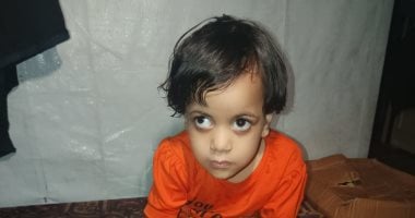 طفلة تُولد مرتين تحت النار في غزة وتعاني من صراع مع المرض ونقص الدواء