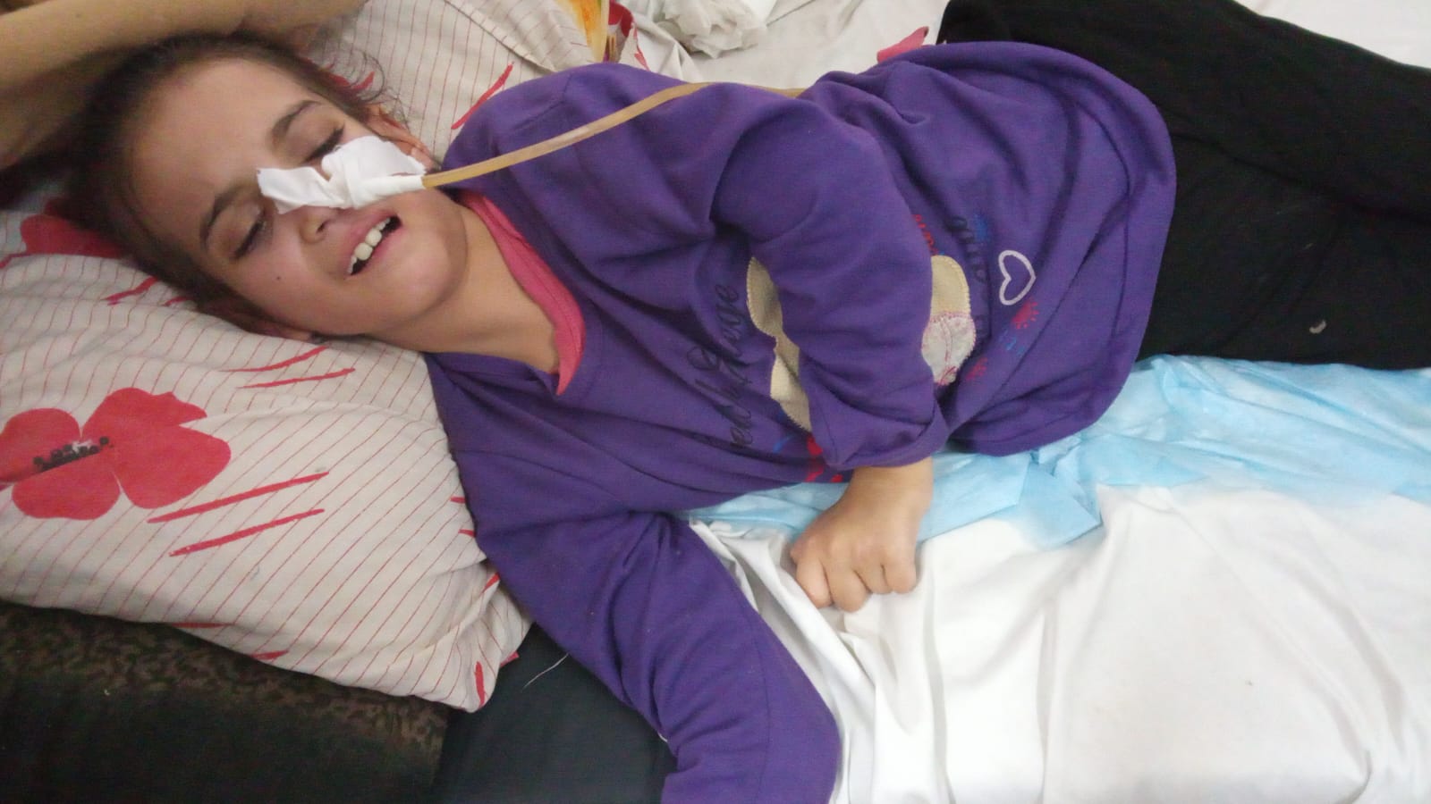 الطفلة المريضة سمر البشيتي