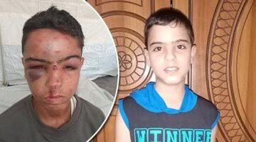 غزة تشهد أزمة صحية خطيرة مع تزايد نوبات الصرع والتشنجات