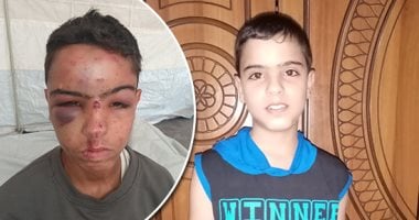 غزة تشهد أزمة صحية خطيرة مع تزايد نوبات الصرع والتشنجات لدى الطفل عبد الله عصفور