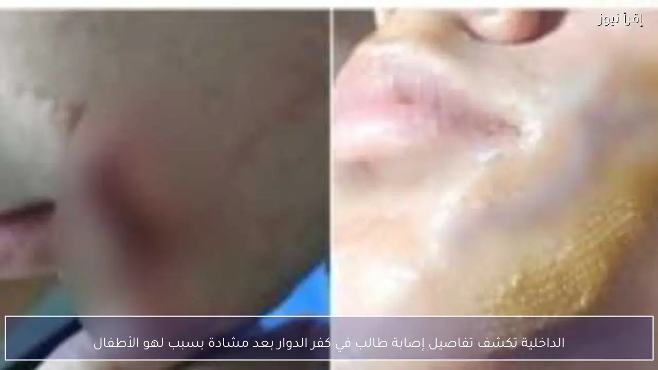 الداخلية تكشف تفاصيل إصابة طالب في كفر الدوار بعد مشادة بسبب لهو الأطفال